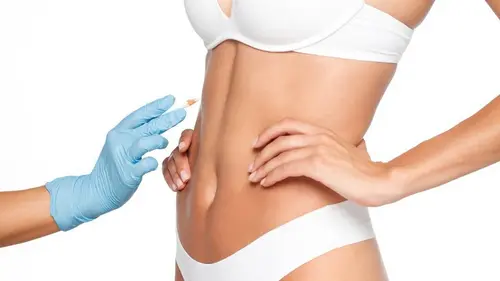 Plastiken nach Höhlenbildung